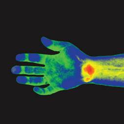 Thermography